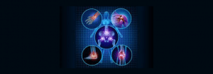 Arthritis and Gluten