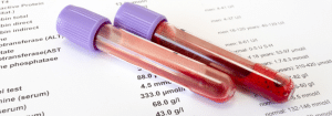 blood analysis